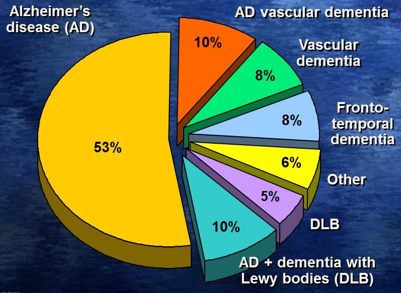 Pie Chart: Alzheimer's Disease (53%), AD vascular dementia (10%), Vascular dementia (8%), Frontotemporal dementia (8%), Other (6%), DLB (5%), AD+ dementia with DLB (10%).
