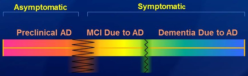 Brain wave diagrams: Asymptomatic (Preclinical AD) - Symptomatic (MCI Due to AD and Dementia Due to AD).
