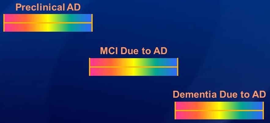 Brain wave diagrams: Preclinical AD, MCI Due to AD, and Dementia Due to AD.