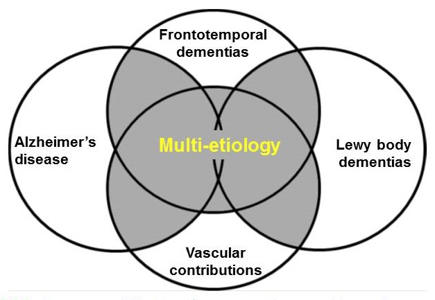 Overlapping diagram showing the intersection of Frontotemporal dementias, Alzheimer's disease, Vascular contributions and Lewy body dementias.