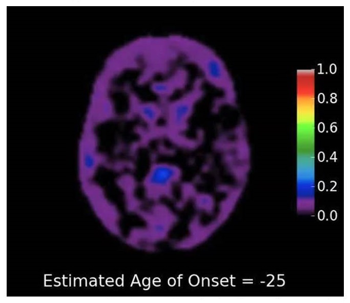 Screen shot of brain scan.