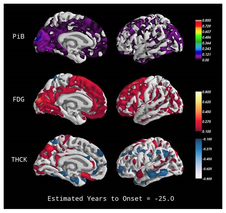 Screen shot of several brain scans.